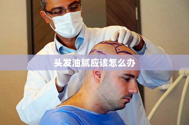如何找到桂林的优质植发门诊