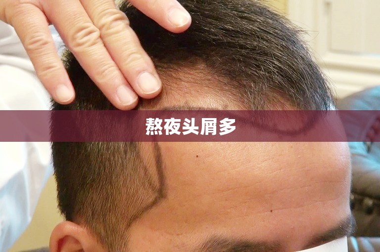惠州如何选择植发门诊：如何找到适合自己的植发机构？