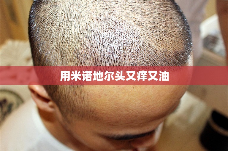 广州公立植发医院那家好？——浅谈广州市三甲医院的植发技术