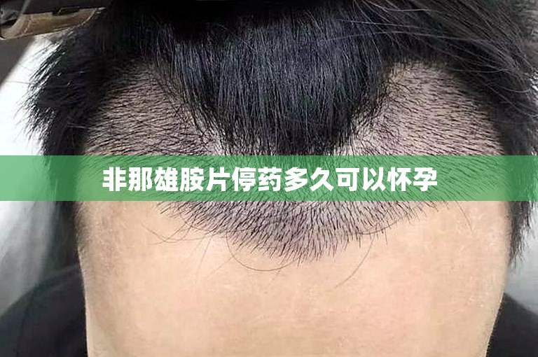 如何选择正规的植发机构在杭州？从医生的角度分析