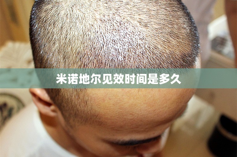 深圳公立植发医院排行榜——选择最适合你的植发医院