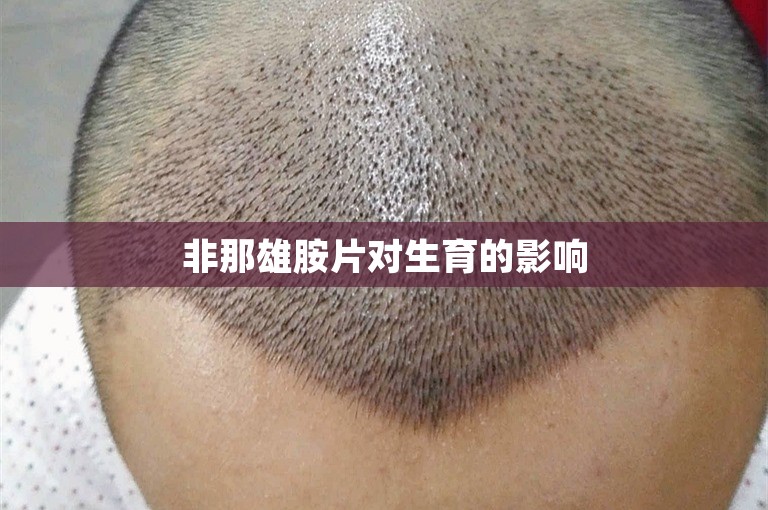 徐州新生植发机构：重塑自信，让发型更好看！