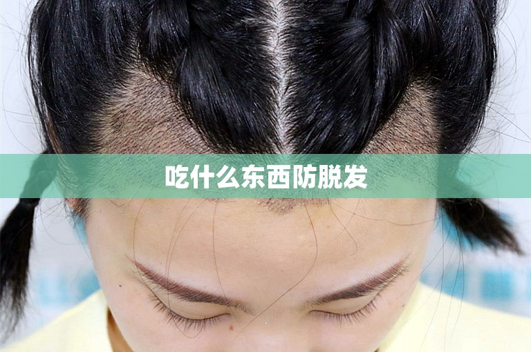 如何选择武汉技术最好的植发门诊？