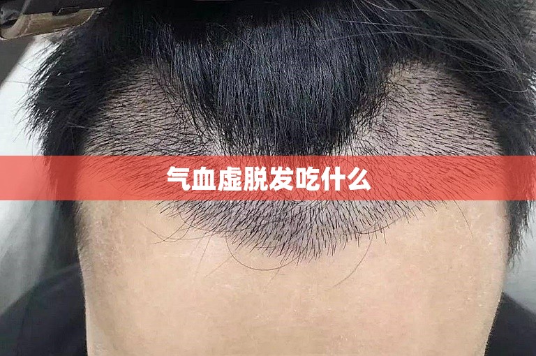 如何选择深圳最权威的植发门诊