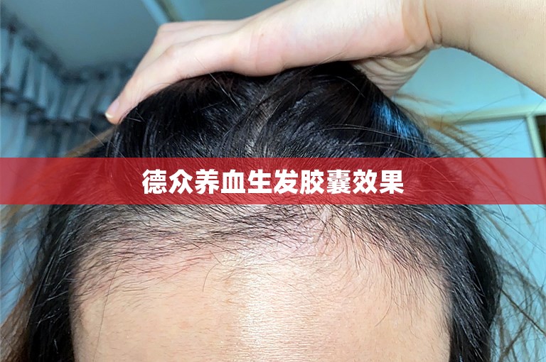 拯救脱发患者的福音——长春最可靠的植发门诊选择攻略