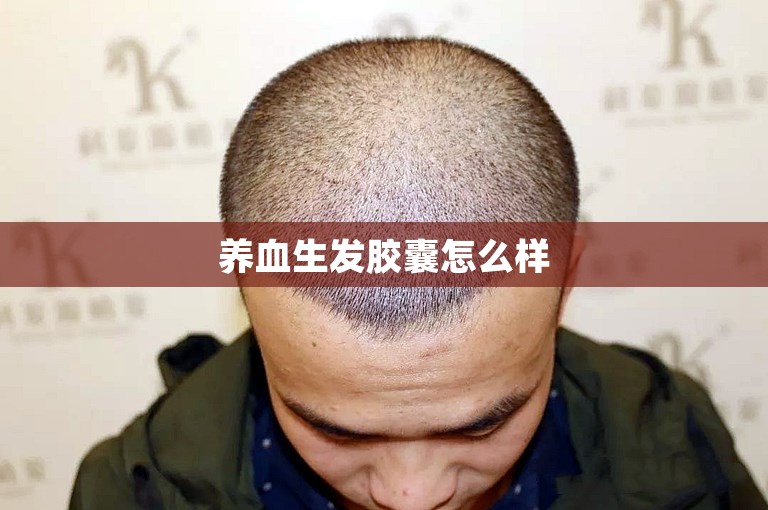 武汉技术好的植发门诊选择方案