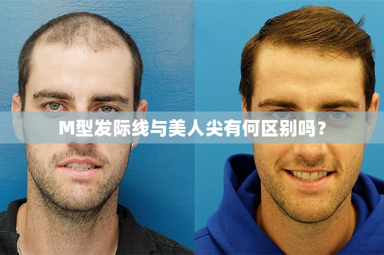 谁是上海著名的植发医生？他们的选择方案是什么？