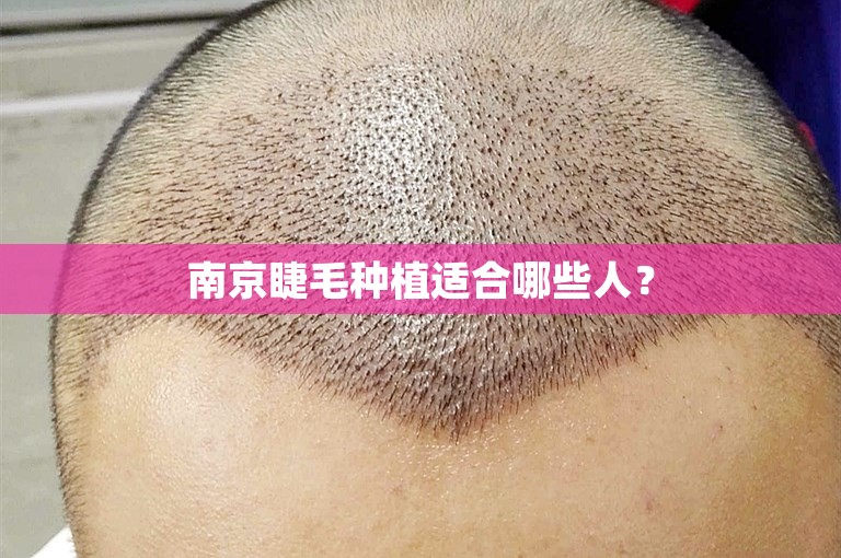 南京睫毛种植适合哪些人？