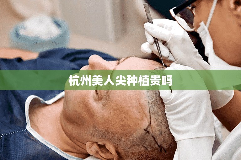 郑州公认最好的植发医生选择攻略