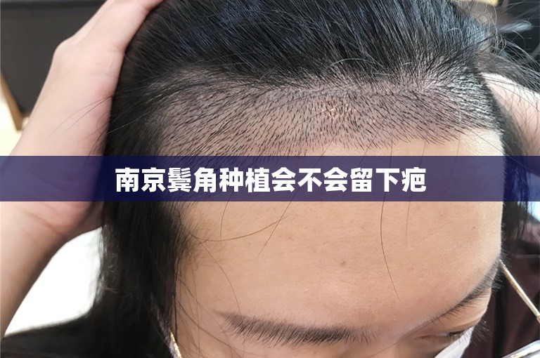 头发不再凋零，北京大麦植发医院靠谱吗？