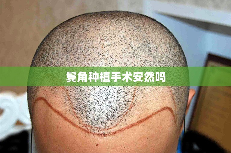 外国人如何选择武汉的植发医院——来自医生的建议
