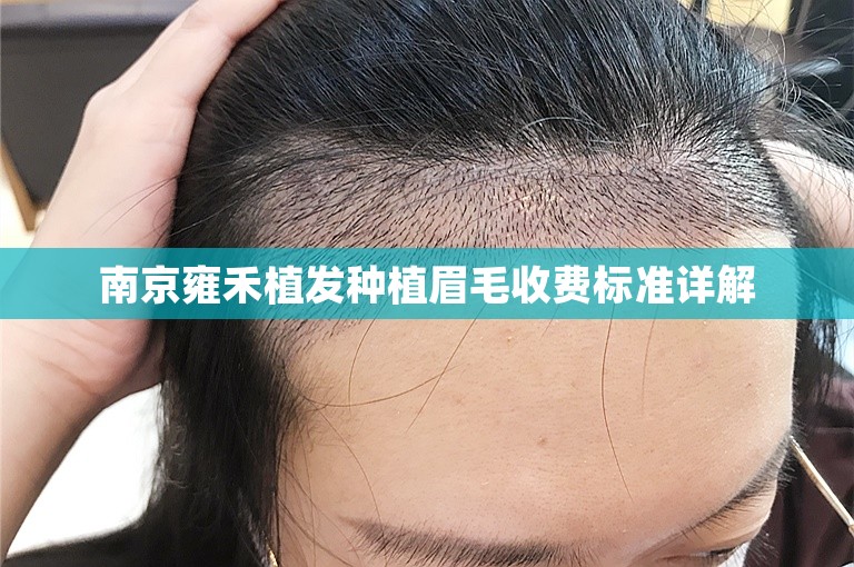 南京雍禾植发种植眉毛收费标准详解