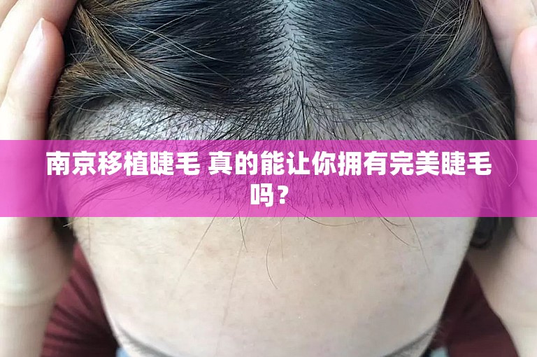 南京移植睫毛 真的能让你拥有完美睫毛吗？