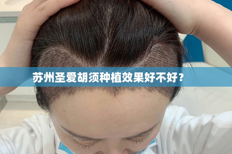 头发少，人生苦？我的植发经历和台州好医院选择攻略