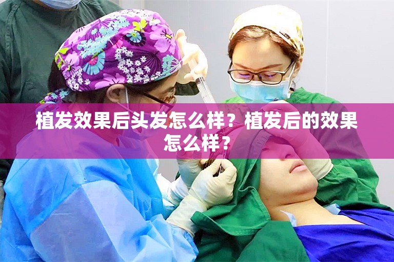 从医生角度看郑州雍禾植发医院口碑如何？