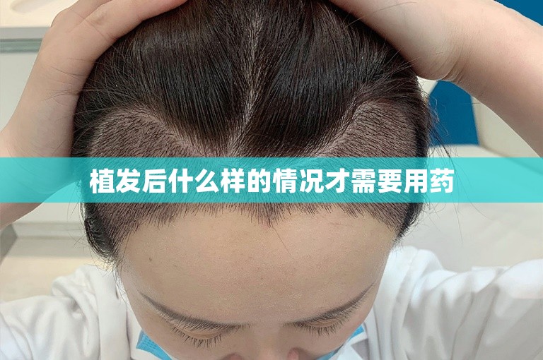 谁能告诉我，太原哪家植发机构比较好？——一个中国脱发人士的疑惑