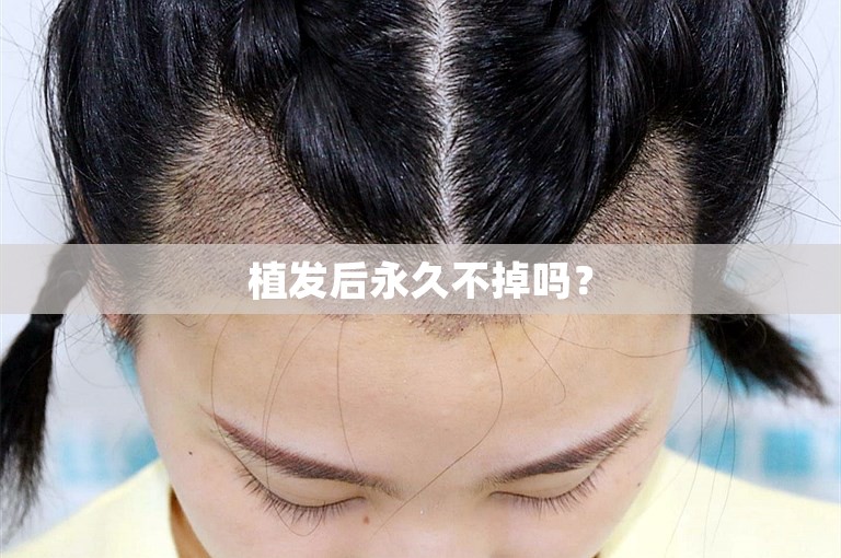 如何选择北京比较好的植发医院？