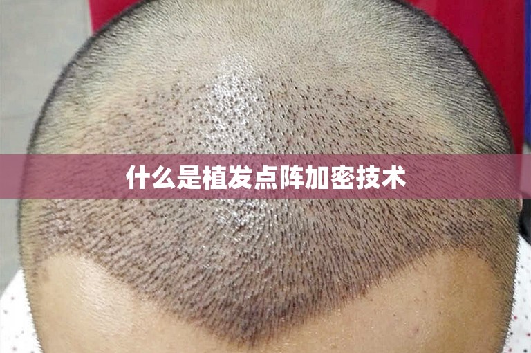 了解徐州知名植发医院的选择方案