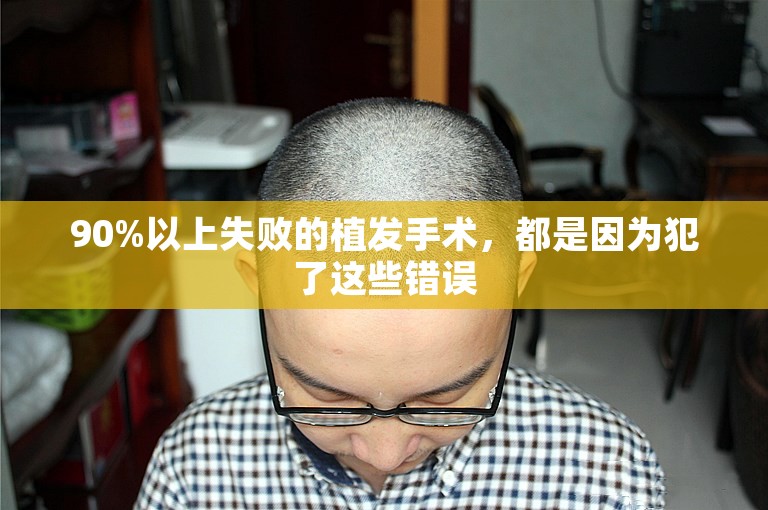 南京最安全的植发门诊怎么选