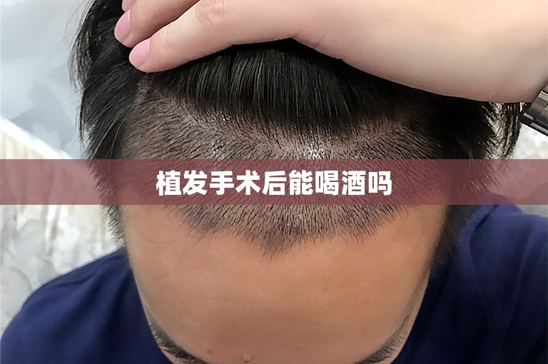 “新头发，新生活”——中国脱发患者的求医之路