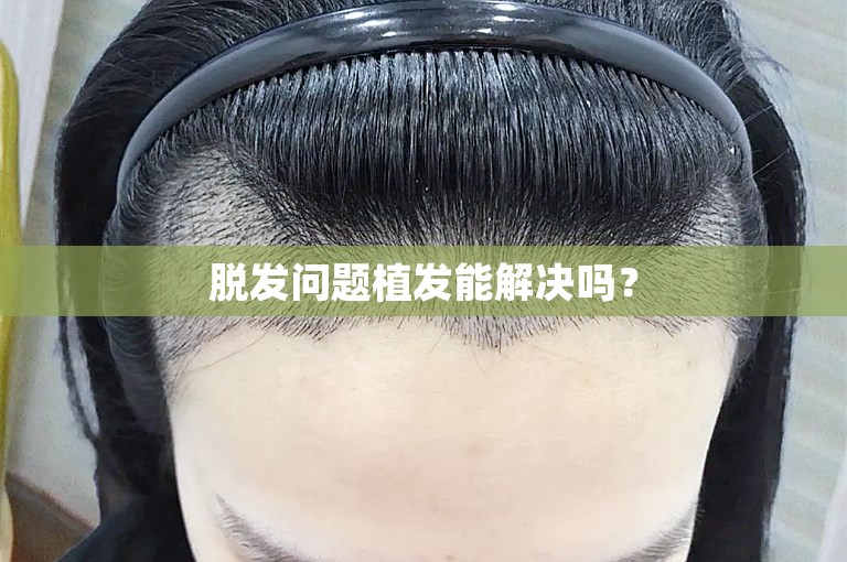 广州植发医院搜寻日记：如何找到最安全的植发专家？