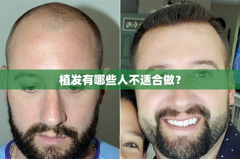 武汉植发门诊，如何选择？
