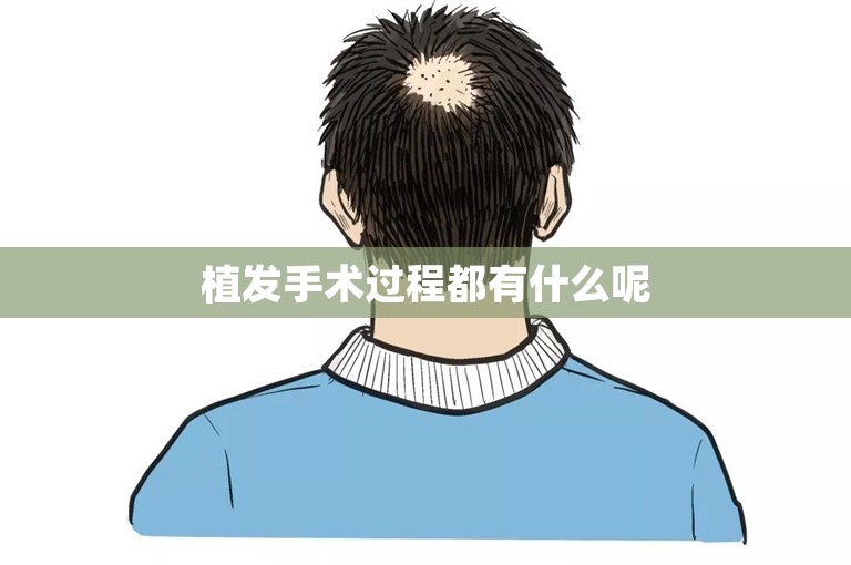 惠州著名的植发门诊怎么选