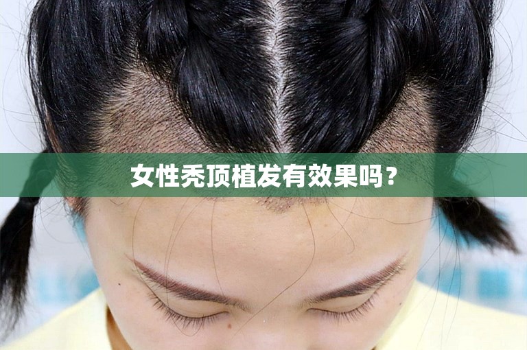 广州碧莲盛植发医院，专业植发给您带来美好生活