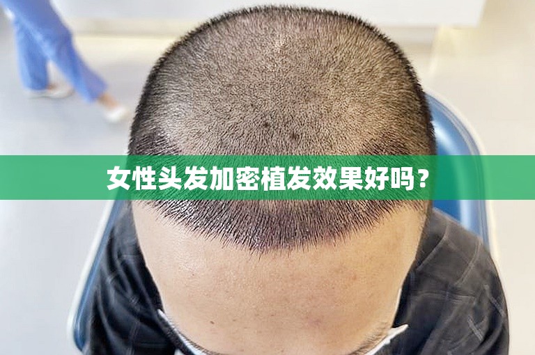 上海植发医院的如何选择