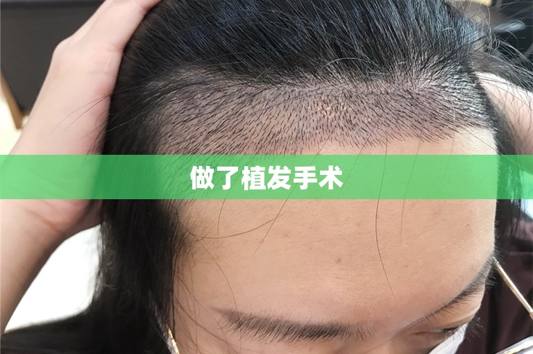 中国植发门诊那个技术好？