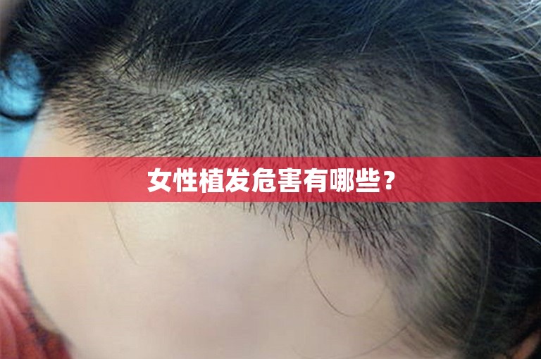 北京比较好的植发医生选择方案