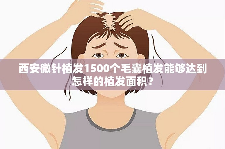 西安微针植发1500个毛囊植发能够达到怎样的植发面积？