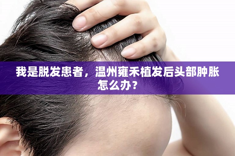 我是脱发患者，温州雍禾植发后头部肿胀怎么办？