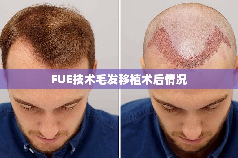 重庆有名的植发门诊选择方案