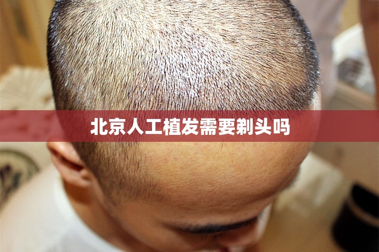 北京人工植发需要剃头吗