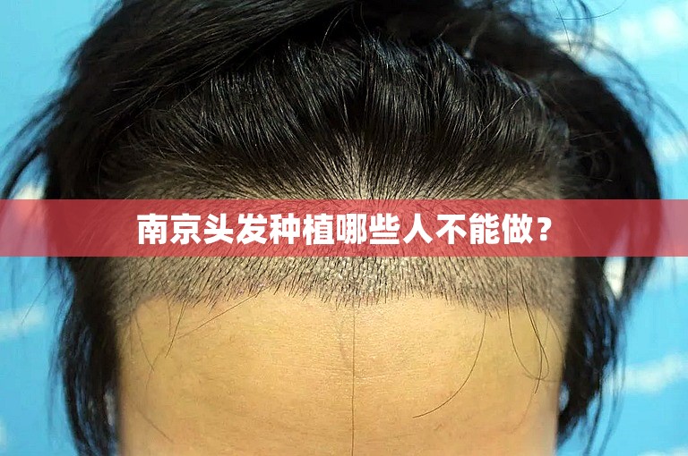 南京头发种植哪些人不能做？