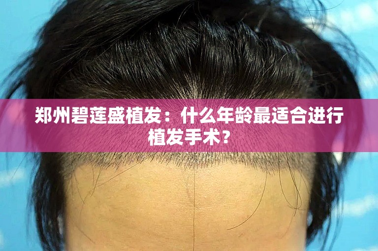 郑州碧莲盛植发：什么年龄最适合进行植发手术？
