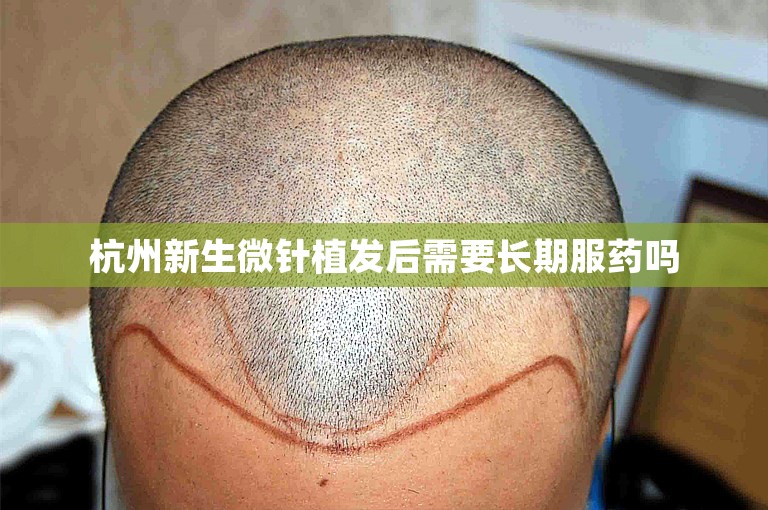 杭州新生微针植发后需要长期服药吗
