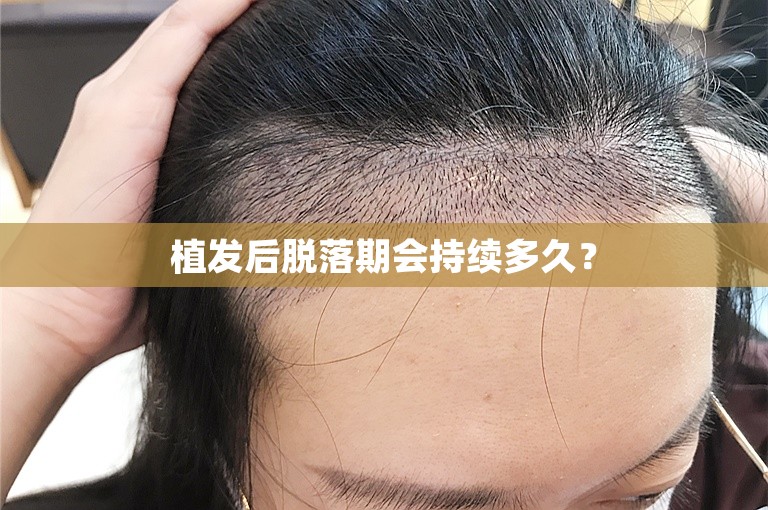 上海新生植发医院正规吗？
