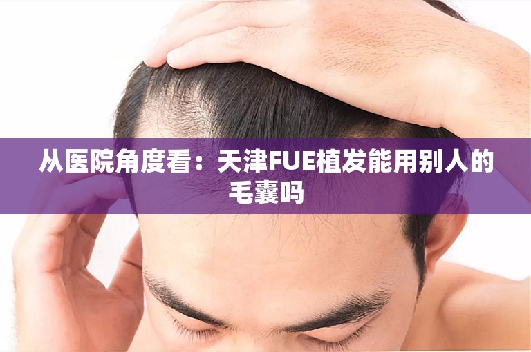 从医院角度看：天津FUE植发能用别人的毛囊吗