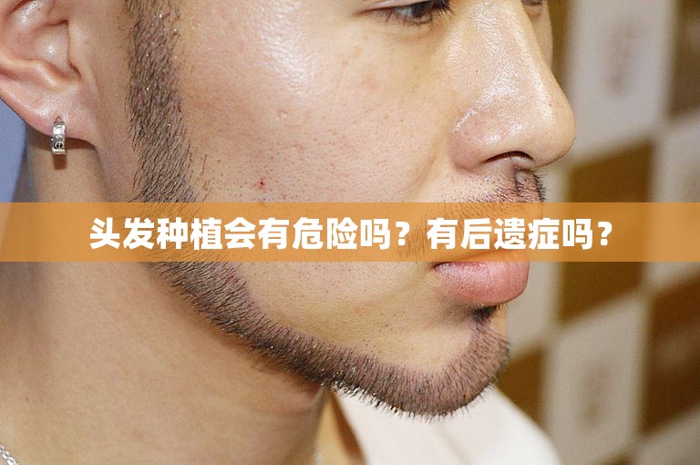 广州技术好的植发医生怎么选