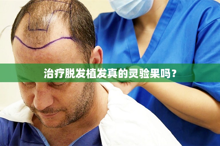 杭州公认最好的植发门诊选择攻略