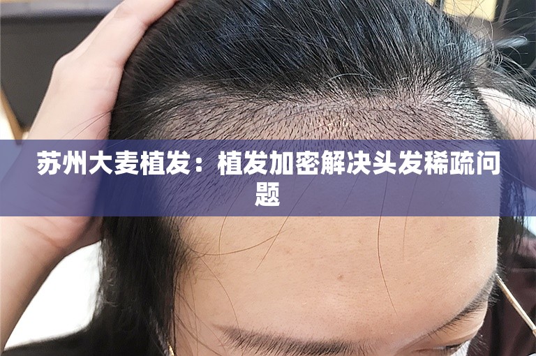 苏州大麦植发：植发加密解决头发稀疏问题