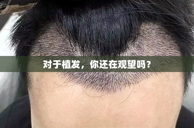 宁波有名的植发门诊怎么选