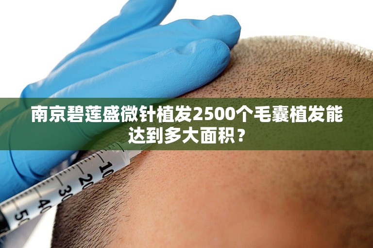 南京碧莲盛微针植发2500个毛囊植发能达到多大面积？