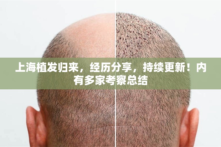 惠州技术好的植发医生选择方案