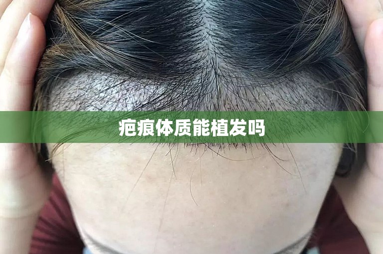 徐州头发种植好点的植发医院选择方案