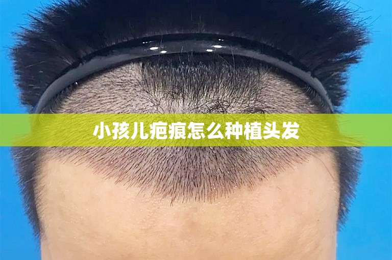 南京技术最好的植发医院怎么选