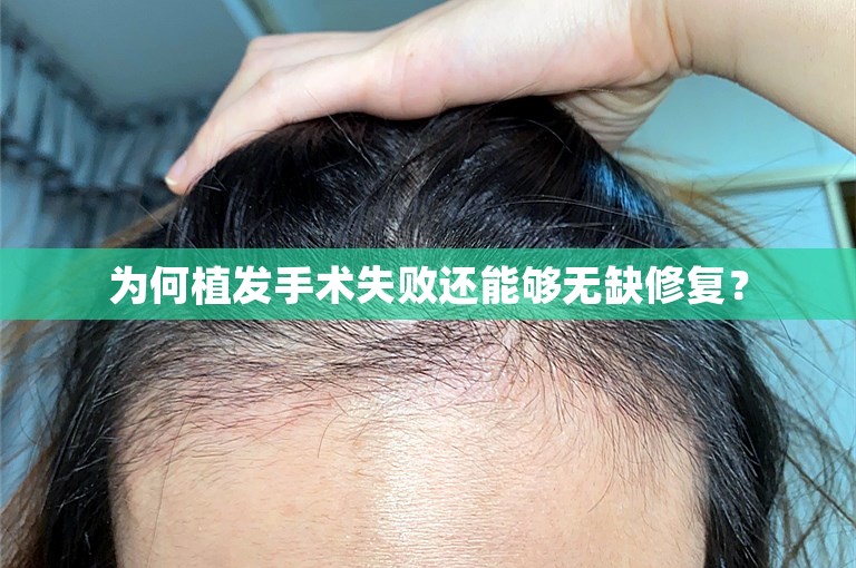 中国新生植发医院可靠吗？