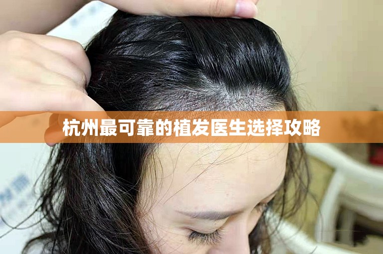 杭州最可靠的植发医生选择攻略